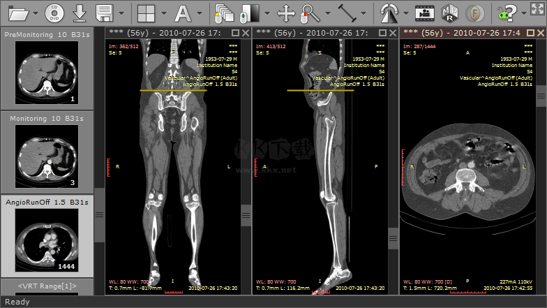 Sante DICOM Viewer Pro(醫學DICOM圖像瀏覽器)