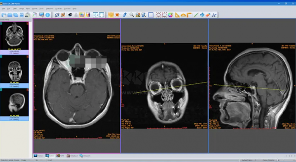 Sante DICOM Viewer Pro(醫學DICOM圖像瀏覽器)