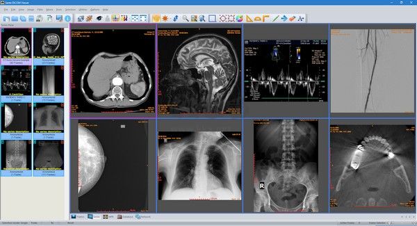 Sante DICOM Viewer Pro(醫學DICOM圖像瀏覽器)